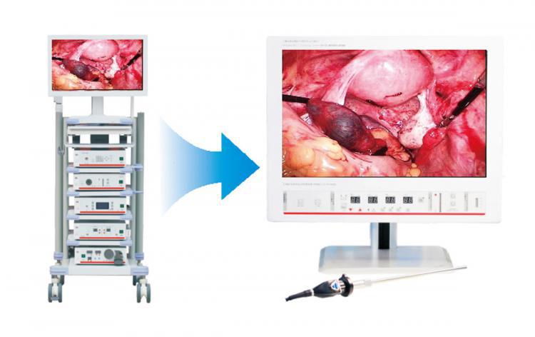 CITEC™ 4K system do endoskopii/CITEC™ 4K Endoscopy System